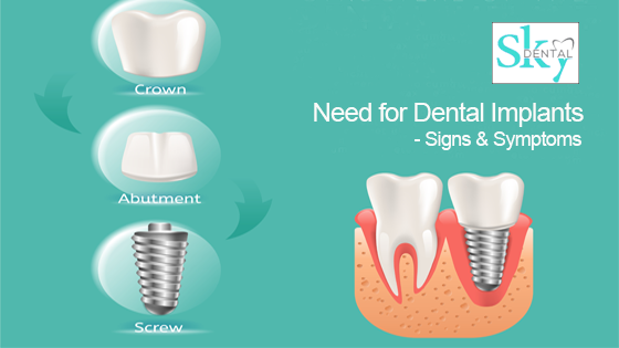 need for dental implants
