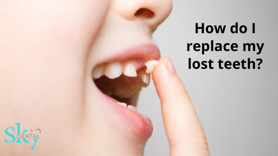 How do I replace my lost teeth?