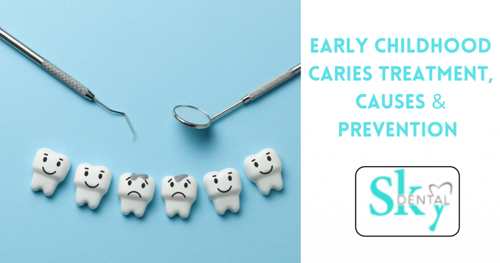 Early Childhood Caries Treatment, Causes & Prevention