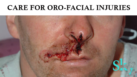 Care for Oro-facial injuries