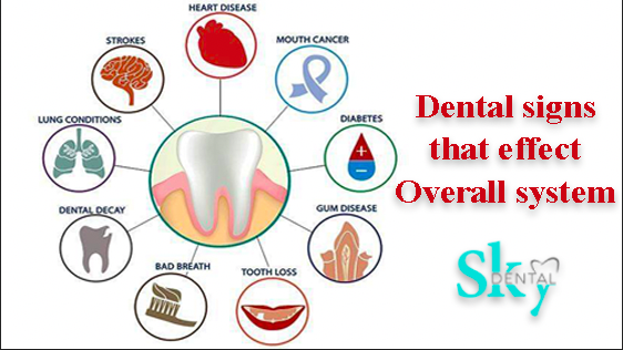 Dental signs that effect the overall health