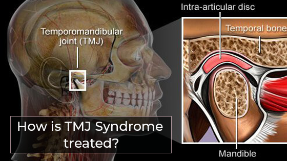What is tmj syndrome and how it is treated?