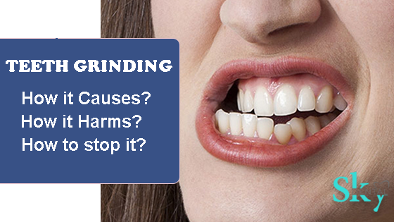 Causes and Treatment for Grinding Teeth