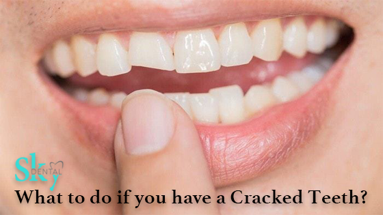 What should I do if my tooth cracks