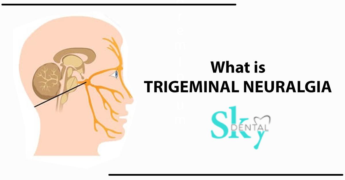 Trigeminal Neuralgia Tooth Pain
