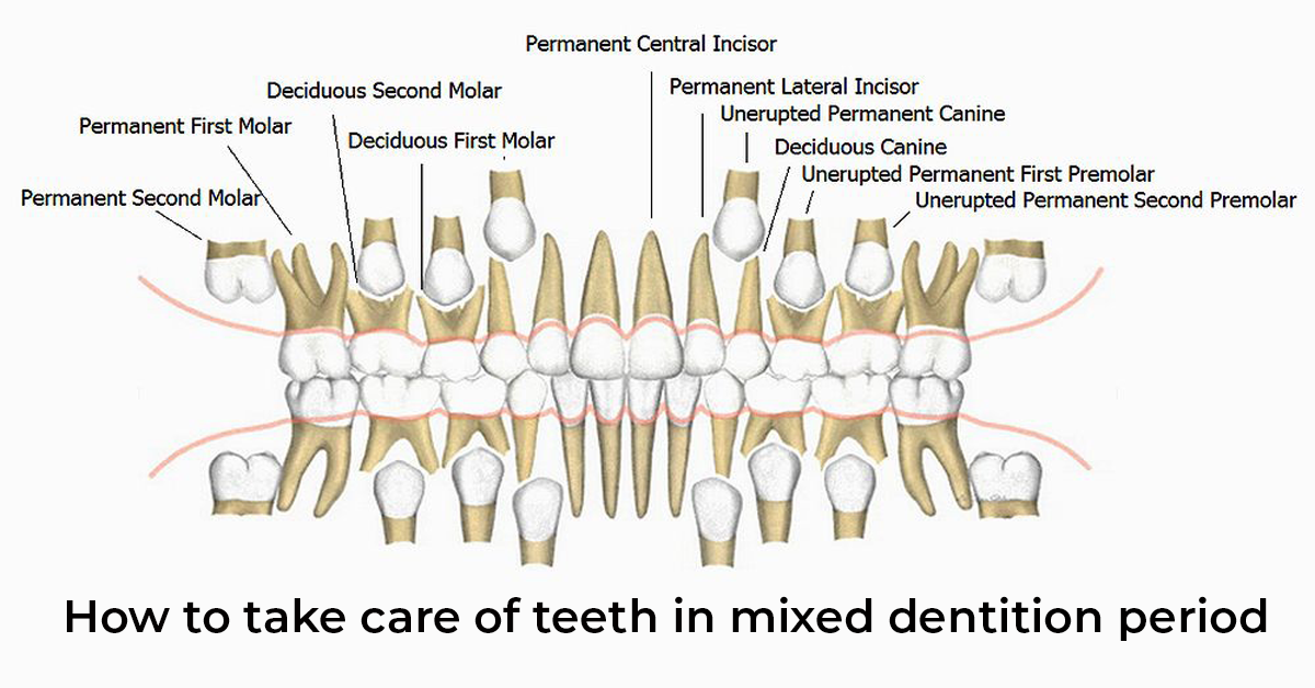 How To Take Care Of Teeth In Mixed Dentition Period Sky Dental Care