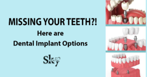 dental implant options
