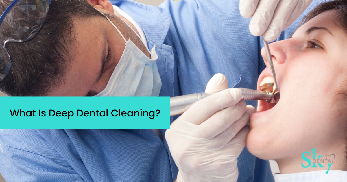 What is Deep Dental Cleaning? Sky Dental Clinic