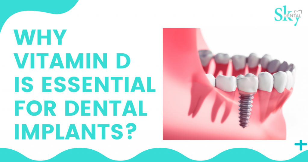 vitamin d essential for dental implants