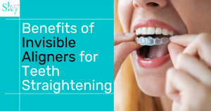 benefits of using invisble aligners for teeth straightening