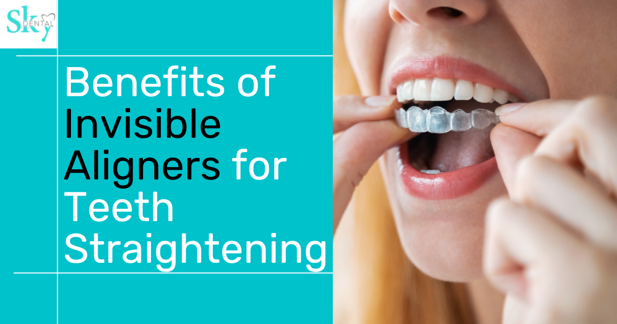 Benefits Of Invisible Aligners For Teeth Straightening Skydental