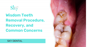Wisdom Teeth Removal Procedure, Recovery, and Common Concerns