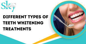 Types of Teeth Whitening