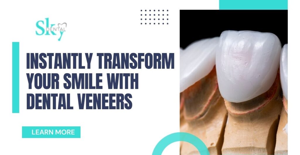 Instantly Transform Your Smile with Dental Veneers