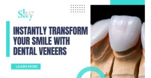 Instantly Transform Your Smile with Dental Veneers