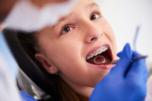 Does Your Child Need Braces? Early Signs & Braces in Vijayawada