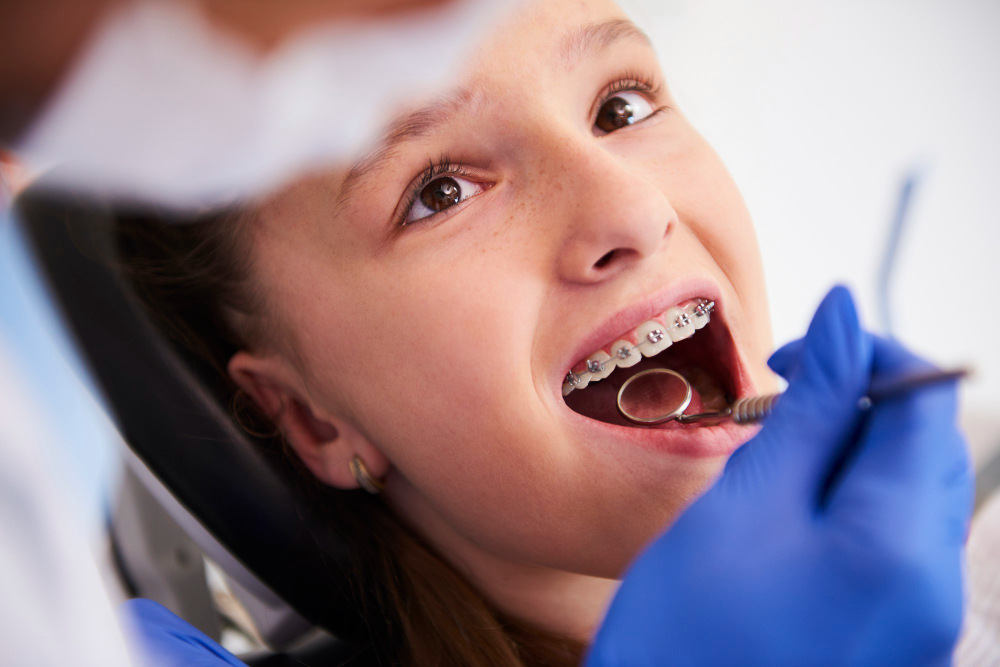 Does Your Child Need Braces? Early Signs & Braces in Vijayawada