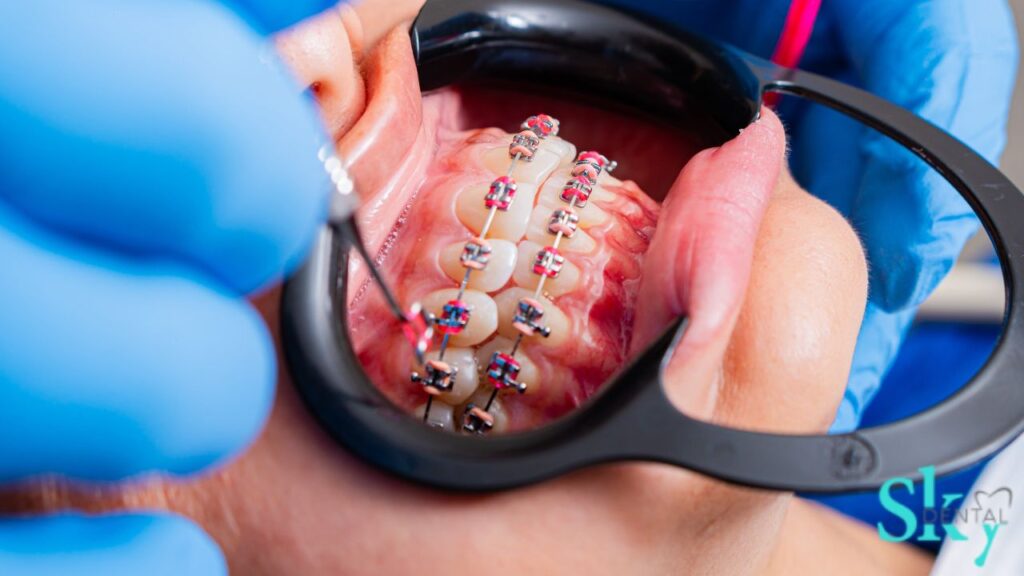 gum disease treatment in vijayawada