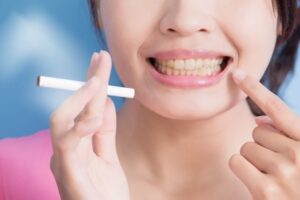 Study Shows Clear Link Between Tooth Growth and Smoking Habit