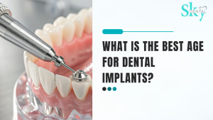 What is the best age for dental implants?