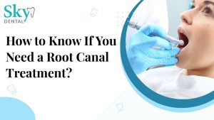 How to Know If You Need a Root Canal Treatment?