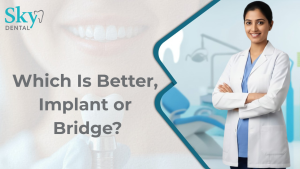 Which Is Better, Implant or Bridge?
