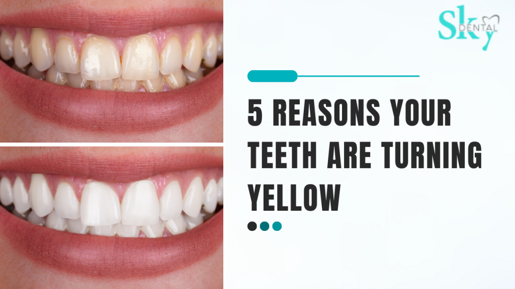 5 Reasons Your Teeth Are Turning Yellow
