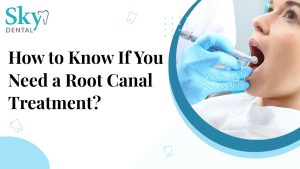 How to Know If You Need a Root Canal Treatment?