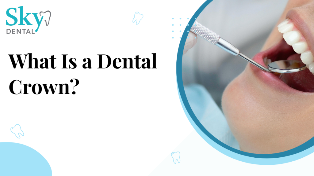 What Is a Dental Crown?