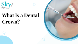 What Is a Dental Crown?