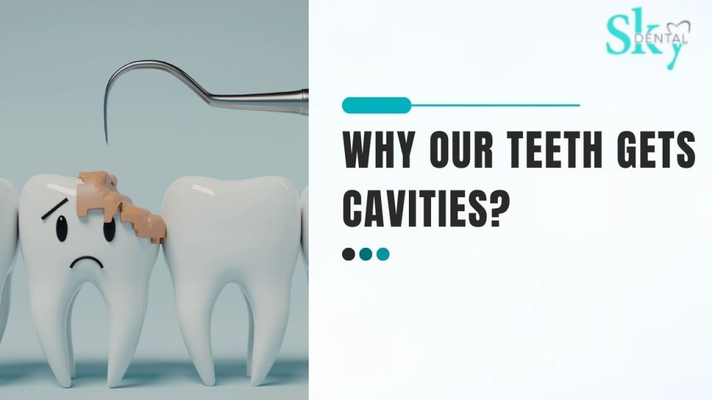 Why our teeth gets cavities?