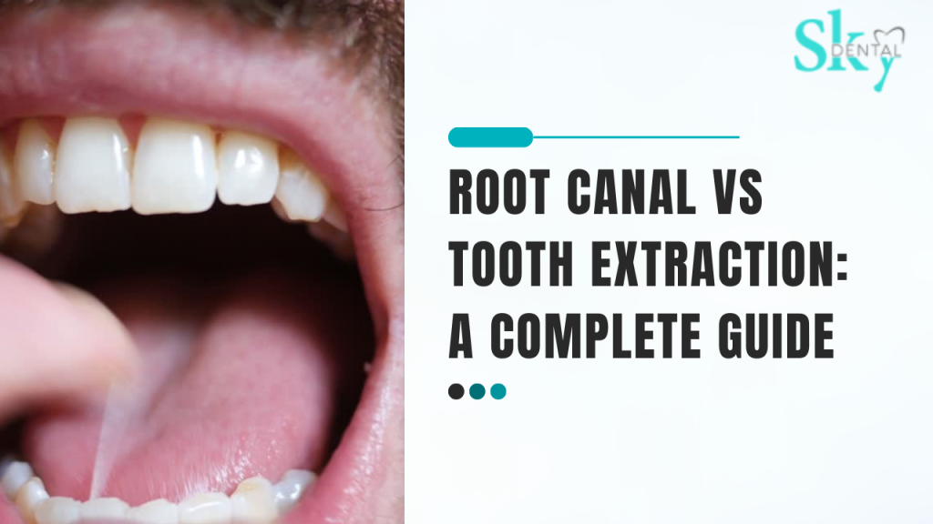 Root canal vs Tooth extraction: A Complete Guide