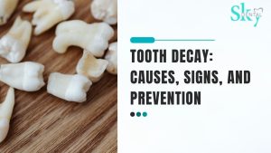 What is tooth decay and how to prevent it?