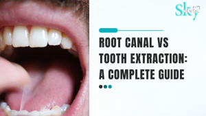 root canal vs tooth extraction