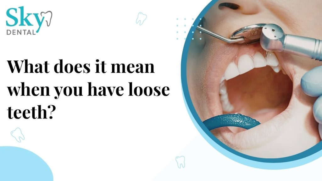 loose teeth
